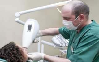 Можно ли делать рентген зубов при беременности — мнения врачей