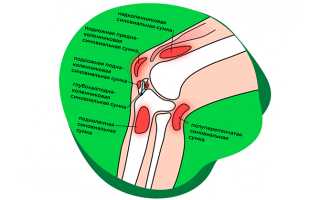 Причины болей в колене при сгибании и разгибании — методы лечения
