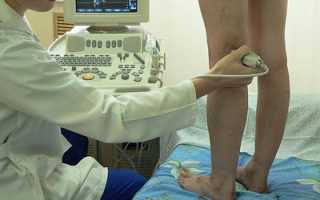 Процедура УЗИ коленного сустава: что показывает