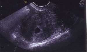 3 Недели беременности от зачатия