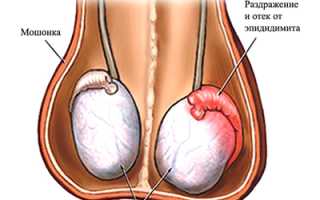 Отчего возникает боль в паху у мужчины