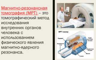 Основные признаки проявления вертеброгенной цервикокраниалгии — методы лечения