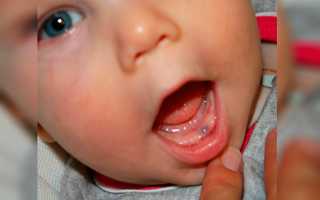 Как прорезаются зубы у ребенка — график, симптомы, как помочь малышу в это время