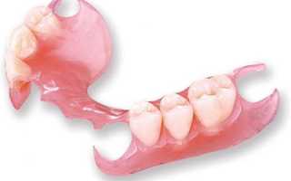 Виды зубных протезов — классификация