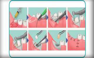 Виды смещения зубов: причины, эффективные способы лечения