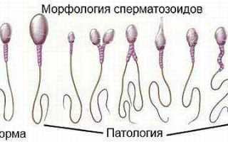 Анализ на подвижность сперматозоидов