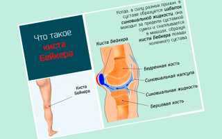 Причины появления жжения в колене — лечение воспаления