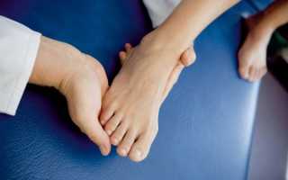 Что такое ревматизм ног: признаки и лечение у детей и взрослых