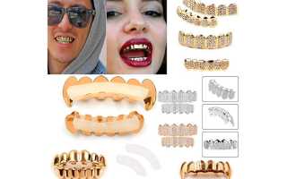 Грилзы на зубах — преимущества и недостатки золотых украшений