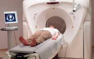 Что такое компьютерная томография и МРТ: в чем разница