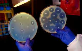 Бактерии возбудители болезней человека