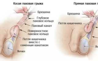 Боли в интимной зоне у мужчин