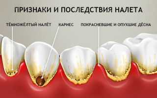 Важность чистки десен и зубов для здоровья человека