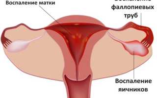 Боль в правом яичнике у женщин