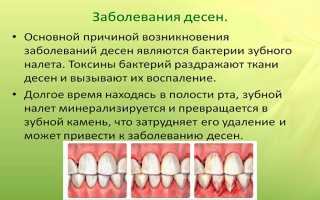 Воспаление и гипертрофия десневых сосочков: возможные причины и методы лечения