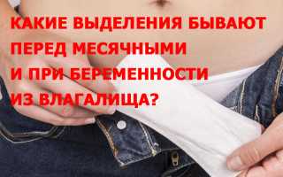 Белые выделения перед месячными признак беременности