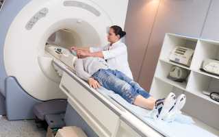 Как проходит МРТ позвоночника и как правильно подготовиться к исследованию