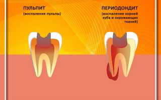 Антибиотики применяемые при воспалении десен и корней зубов